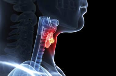 QUAIS OS 12 PRINCIPAIS SINTOMAS DO HIPOTIROIDISMO